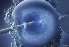 胚胎移植前要注意哪些？